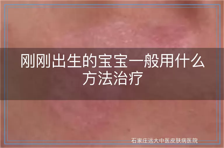 刚刚出生的宝宝一般用什么方法治疗
