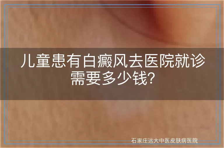 儿童患有白癜风去医院就诊需要多少钱？