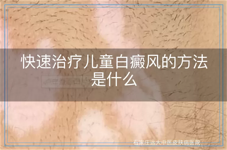 快速治疗儿童白癜风的方法是什么