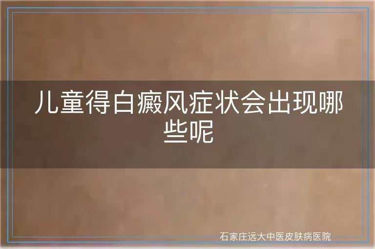 儿童得白癜风症状会出现哪些呢