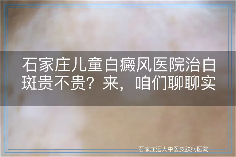 石家庄儿童白癜风医院治白斑贵不贵？来，咱们聊聊实话！