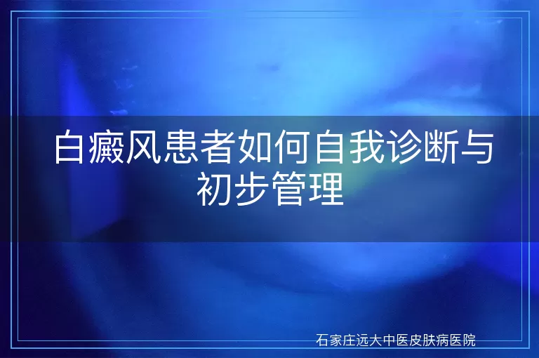 白癜风患者如何自我诊断与初步管理
