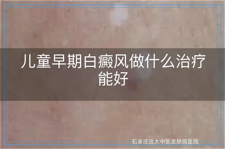 儿童早期白癜风做什么治疗能好