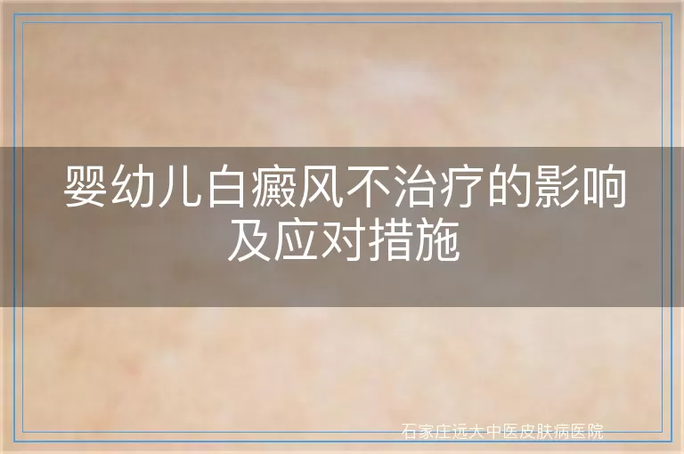 婴幼儿白癜风不治疗的影响及应对措施