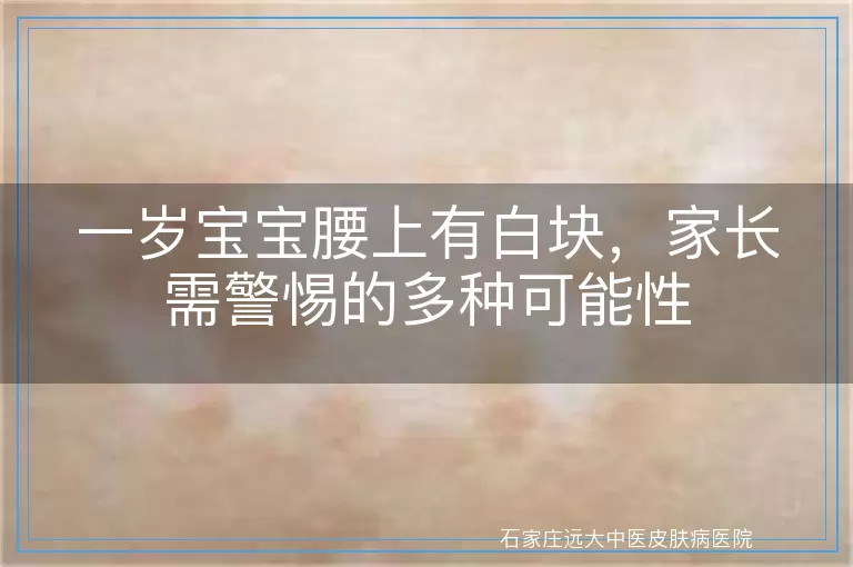 一岁宝宝腰上有白块，家长需警惕的多种可能性
