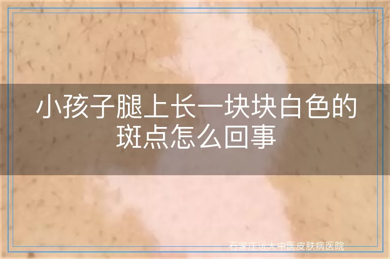 小孩子腿上长一块块白色的斑点怎么回事