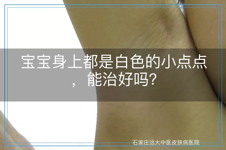宝宝身上都是白色的小点点，能治好吗？