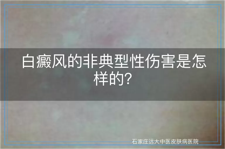 白癜风的非典型性伤害是怎样的？