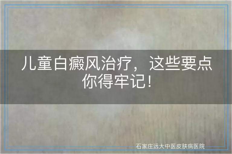 儿童白癜风治疗，这些要点你得牢记！