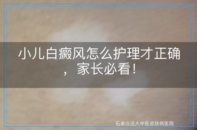 小儿白癜风怎么护理才正确，家长必看！