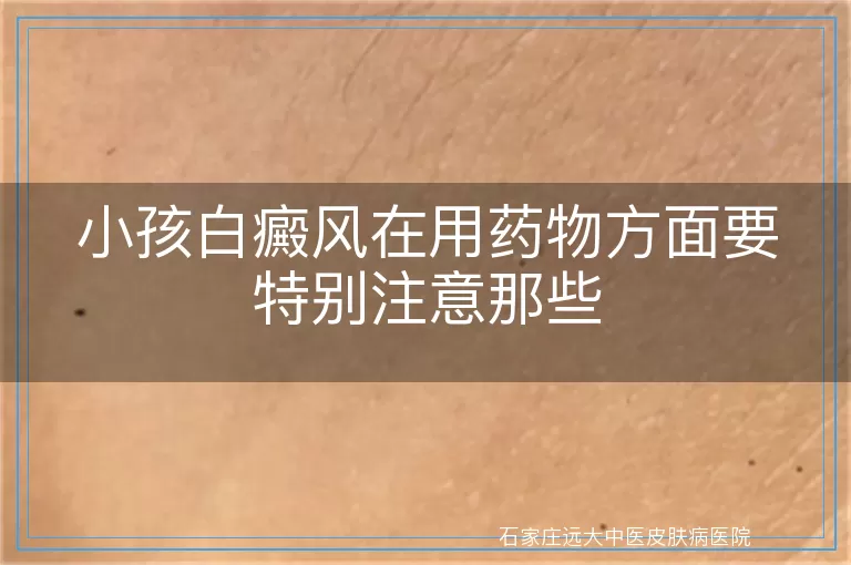 小孩白癜风在用药物方面要特别注意那些