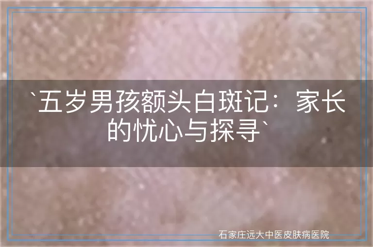五岁男孩额头白斑记：家长的忧心与探寻