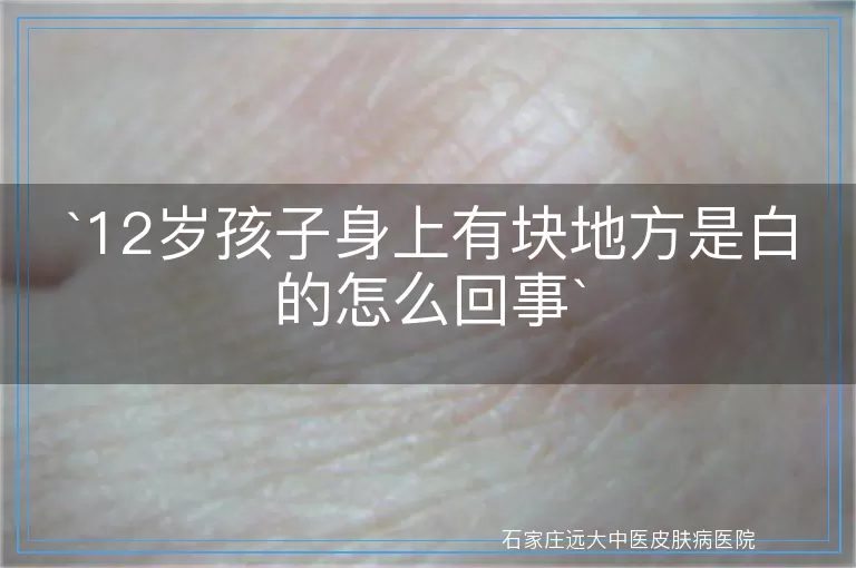 12岁孩子身上有块地方是白的怎么回事