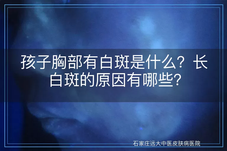 孩子胸部有白斑是什么？长白斑的原因有哪些？