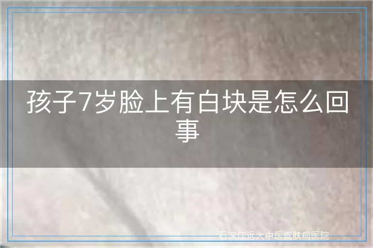 孩子7岁脸上有白块是怎么回事