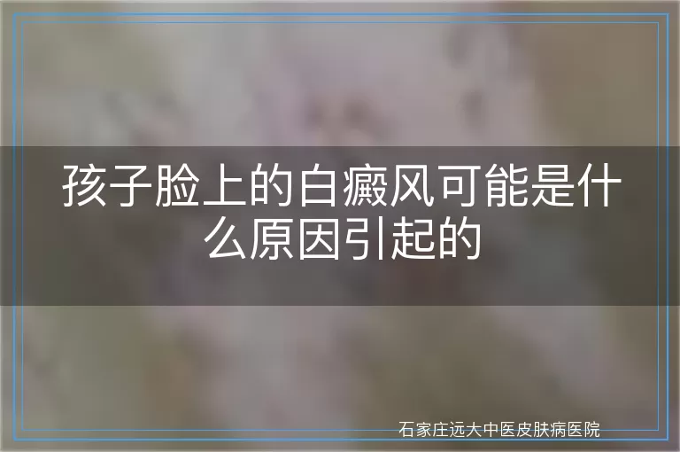 孩子脸上的白癜风可能是什么原因引起的