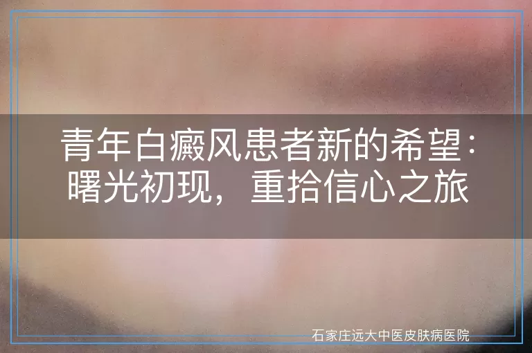 青年白癜风患者新的希望：曙光初现，重拾信心之旅