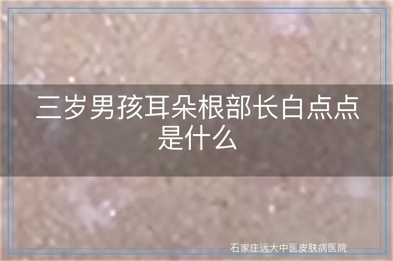 三岁男孩耳朵根部长白点点是什么