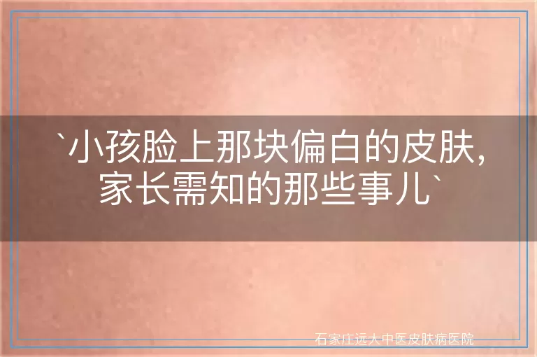 小孩脸上那块偏白的皮肤，家长需知的那些事儿