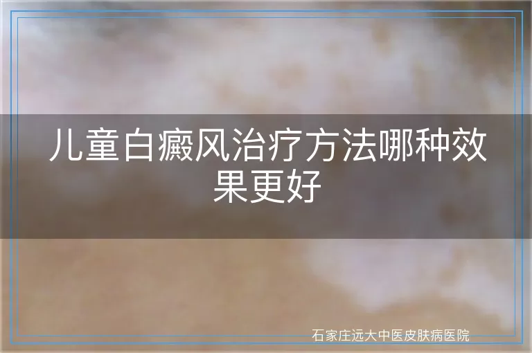 儿童白癜风治疗方法哪种效果更好