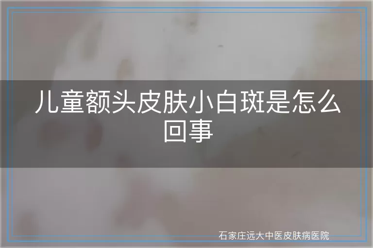 儿童额头皮肤小白斑是怎么回事