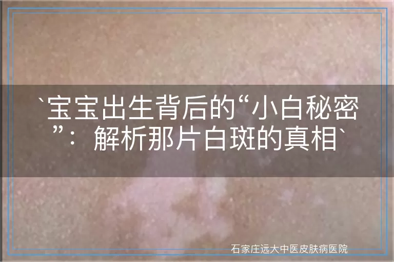 宝宝出生背后的“小白秘密”：解析那片白斑的真相