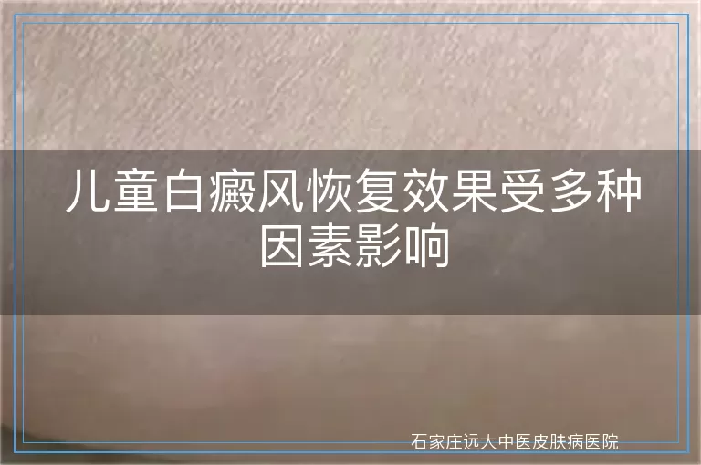 儿童白癜风恢复效果受多种因素影响
