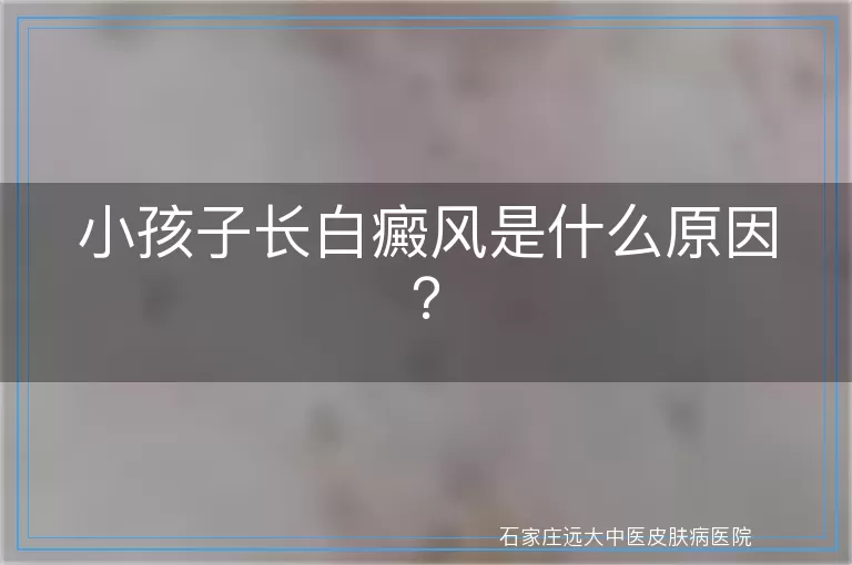 小孩子长白癜风是什么原因？