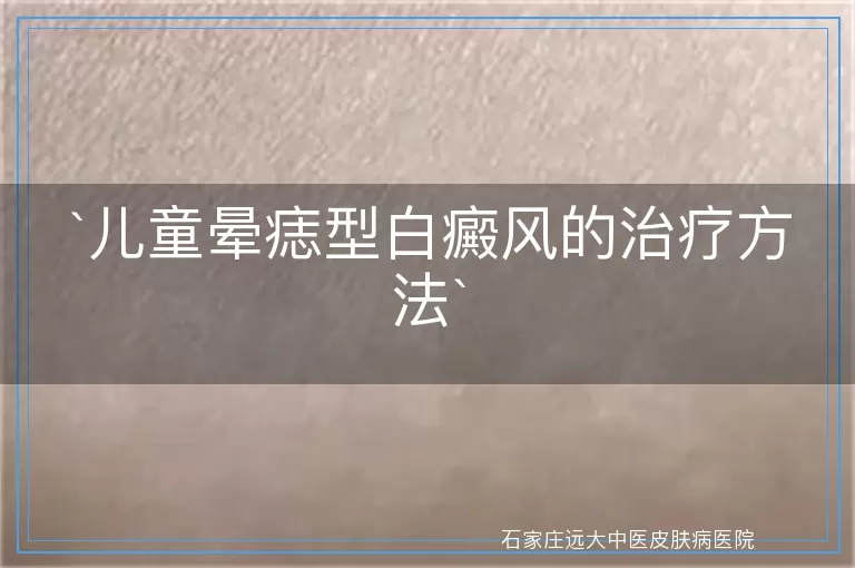 儿童晕痣型白癜风的治疗方法