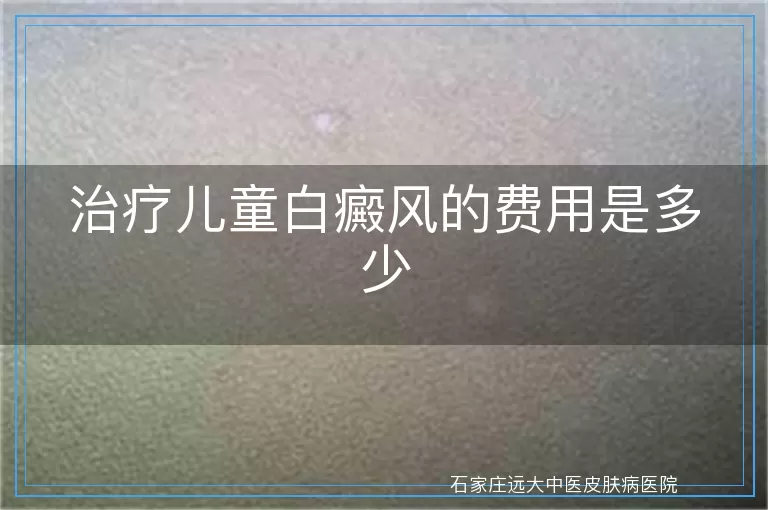 治疗儿童白癜风的费用是多少