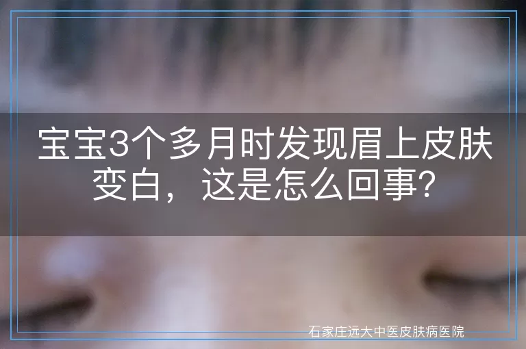 宝宝3个多月时发现眉上皮肤变白,这是怎么回事?