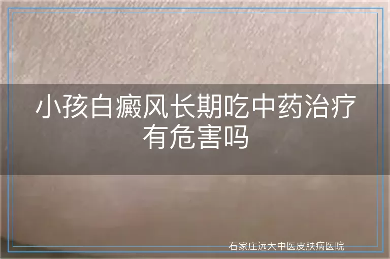 小孩白癜风长期吃中药治疗有危害吗