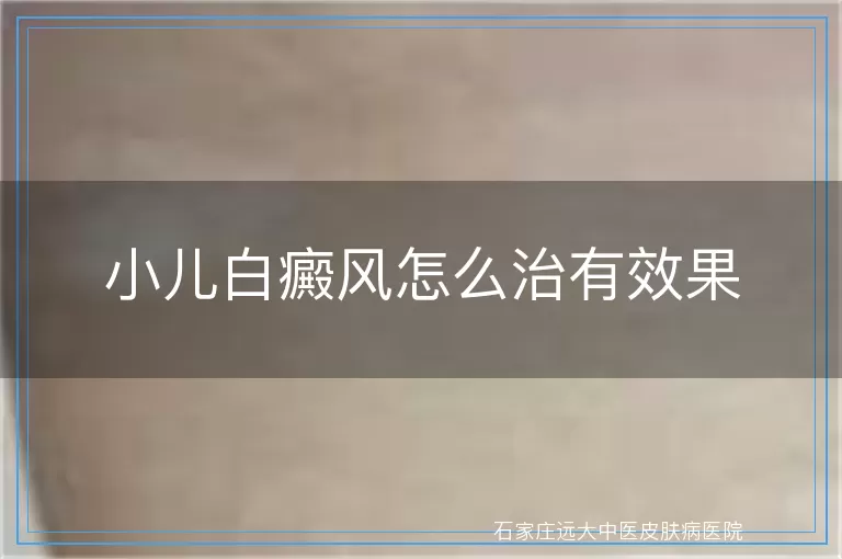 小儿白癜风怎么治有效果