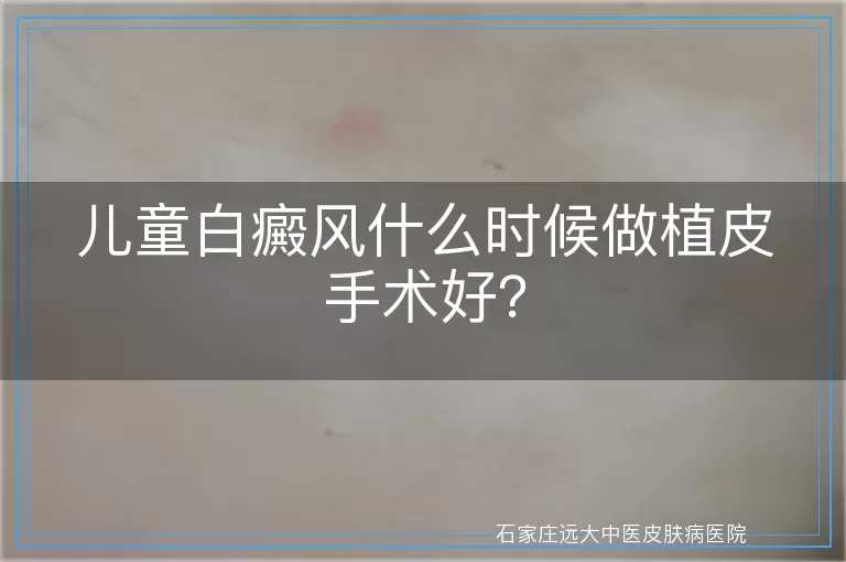 儿童白癜风什么时候做植皮手术好？