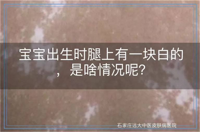 宝宝出生时腿上有一块白的，是啥情况呢？