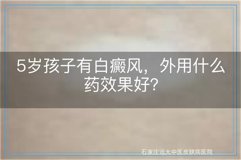 5岁孩子有白癜风，外用什么药效果好？