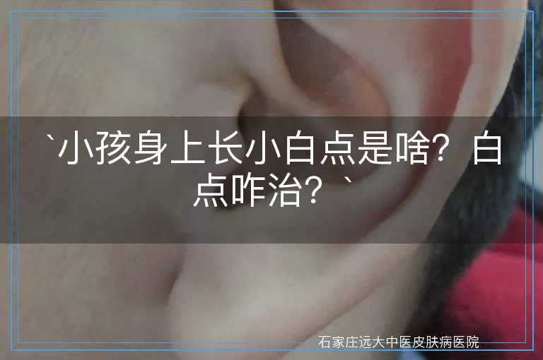 小孩身上长小白点是啥？白点咋治？
