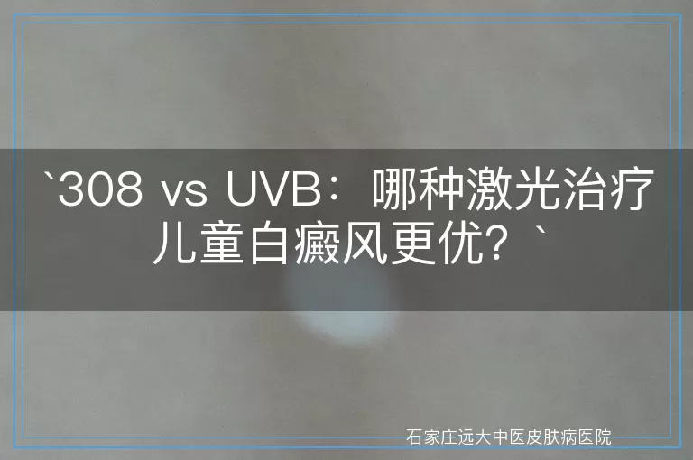 308 vs UVB：哪种激光治疗儿童白癜风更优？