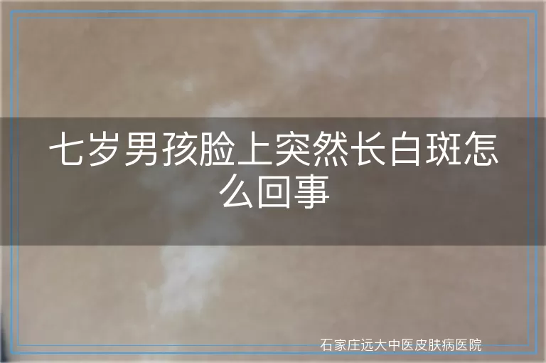 七岁男孩脸上突然长白斑怎么回事