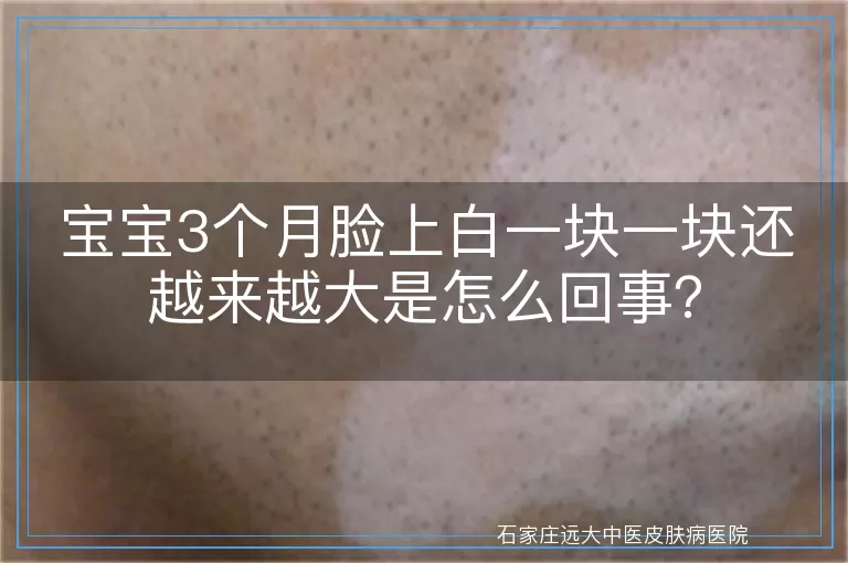 宝宝3个月脸上白一块一块还越来越大是怎么回事？