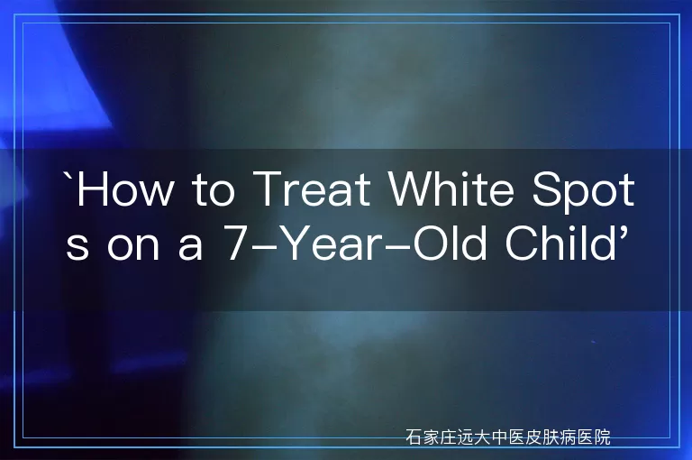 How to Treat White Spots on a 7-Year-Old Child's Hands and Feet Due to Vitiligo