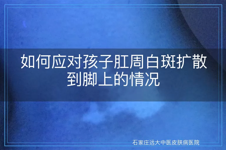 如何应对孩子肛周白斑扩散到脚上的情况