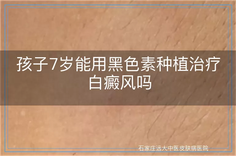 孩子7岁能用黑色素种植治疗白癜风吗
