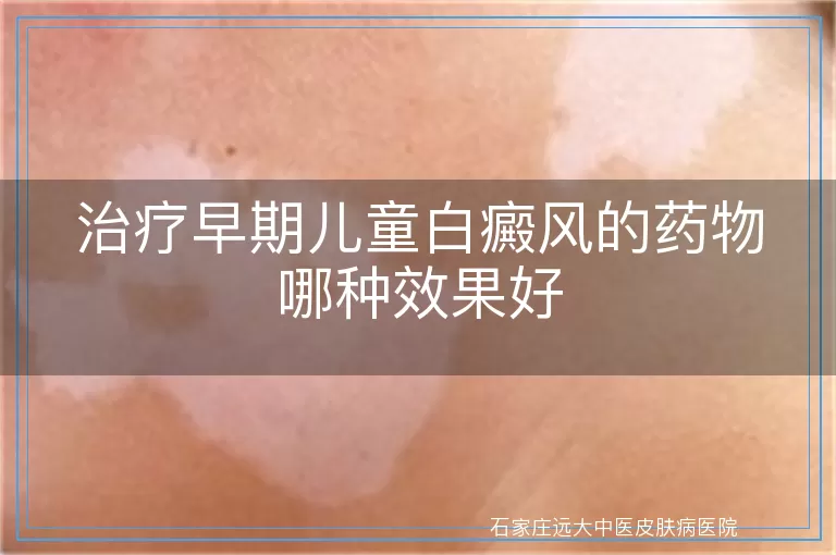 治疗早期儿童白癜风的药物哪种效果好