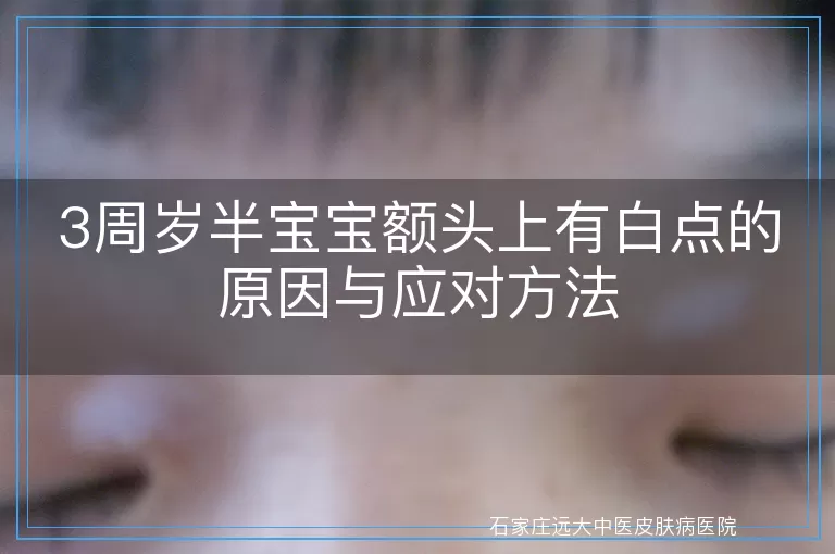 3周岁半宝宝额头上有白点的原因与应对方法