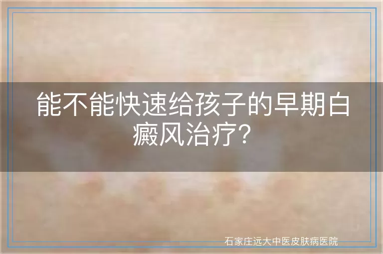 能不能快速给孩子的早期白癜风治疗？