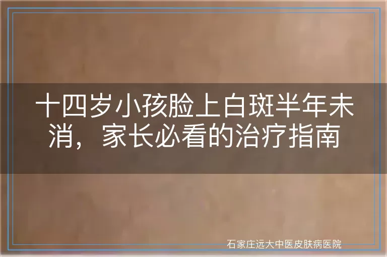 十四岁小孩脸上白斑半年未消，家长必看的治疗指南