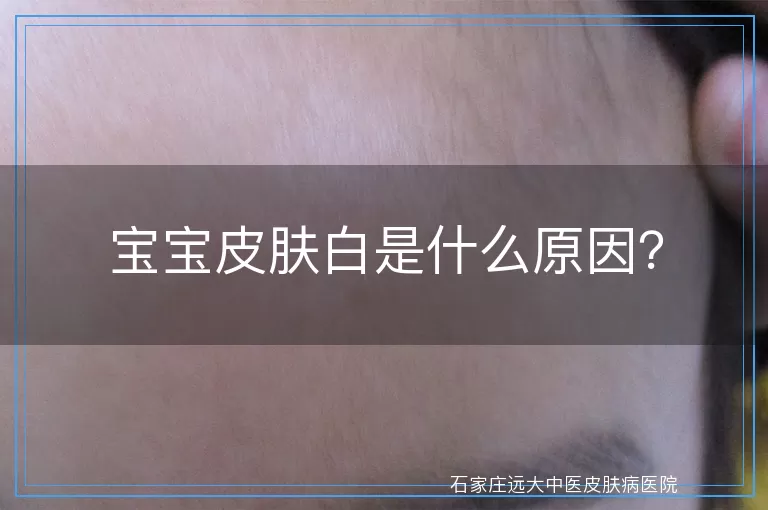 宝宝皮肤白是什么原因？