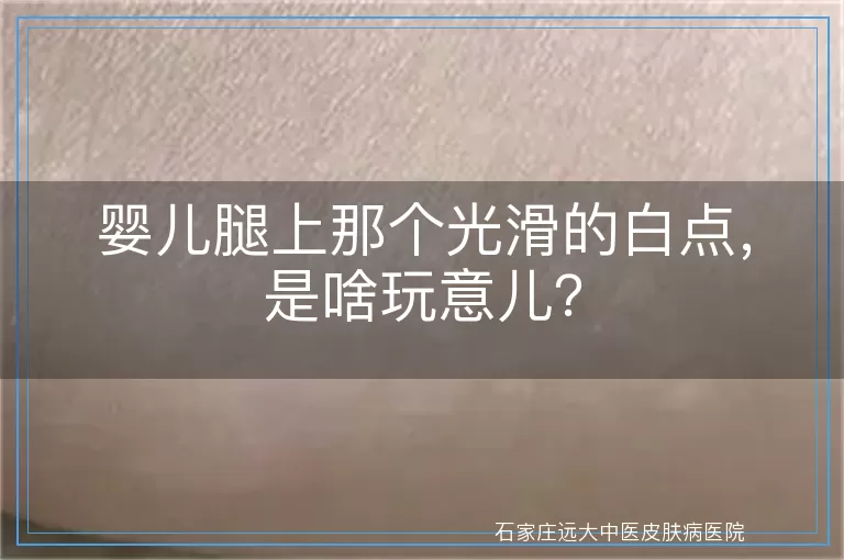 婴儿腿上那个光滑的白点，是啥玩意儿？