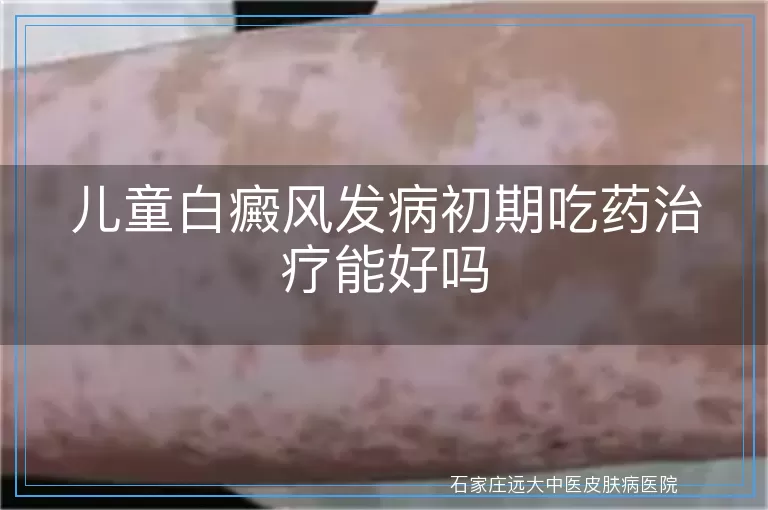 儿童白癜风发病初期吃药治疗能好吗